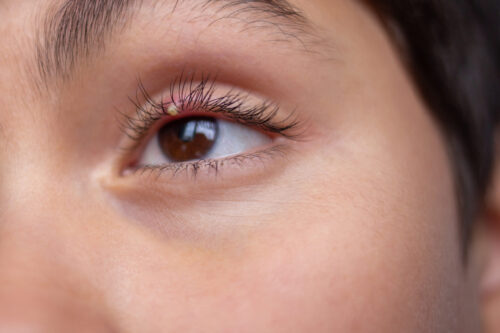 Close up of human eye with small stye on upper eyelid. Macro shot of irritated eye and lashes. Health and medical concept, soft focus, stye